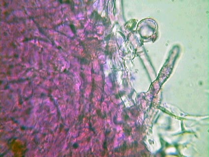 Hydnocystis piligera.